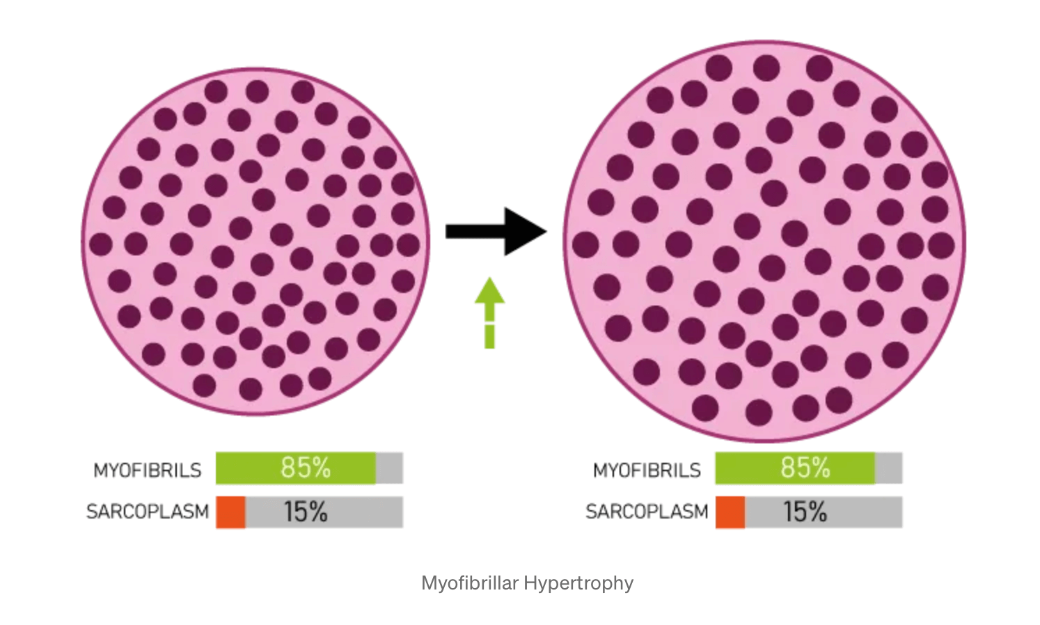 Myofibrilárna Hypertrofia