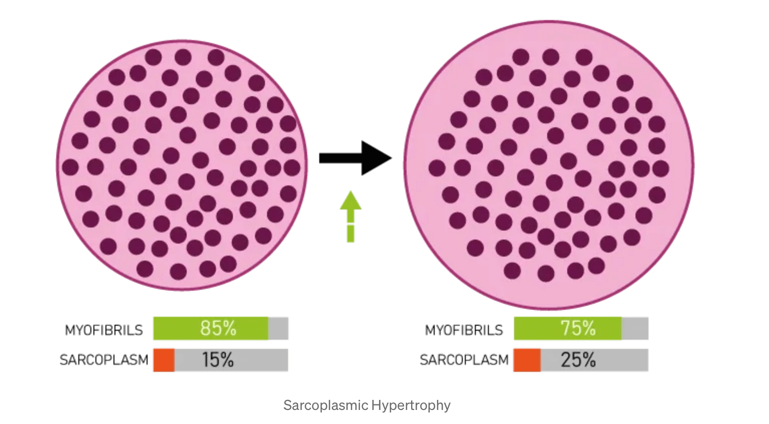 Sarkoplazmická hypertrofia